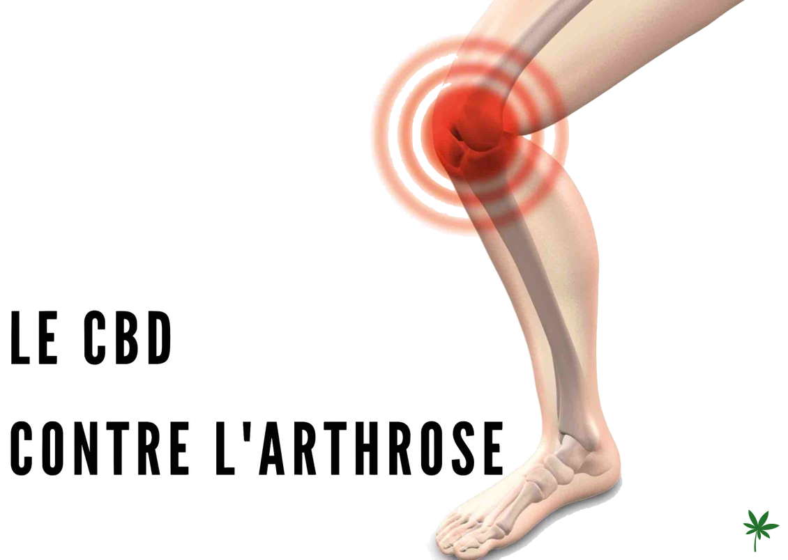 CBD arthrose