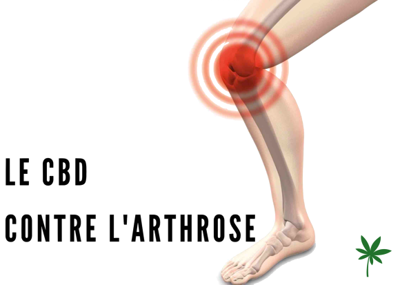 CBD contre l'arthrose