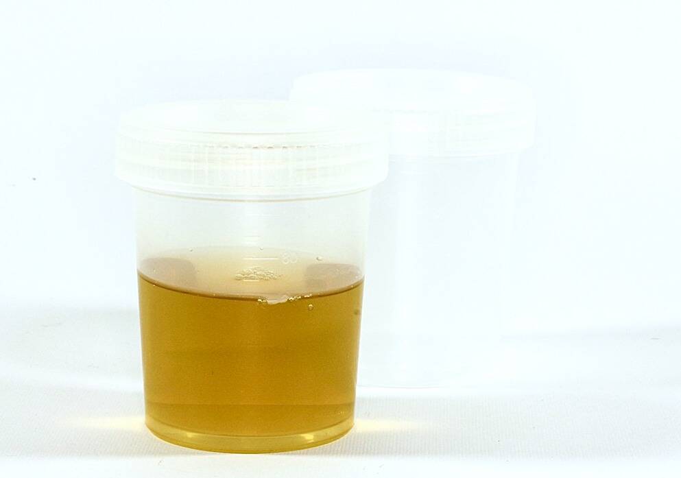cbd test urinaire