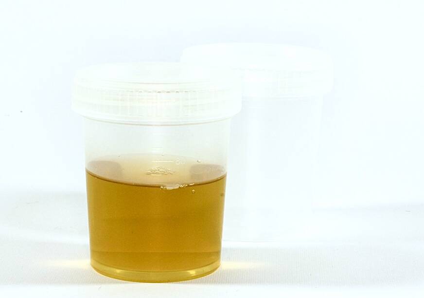 cbd test urinaire